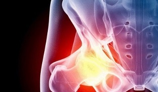 causes of hip osteoarthritis development