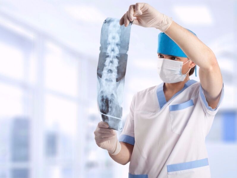 a doctor looks at a shot of the cervical spine with osteochondrosis