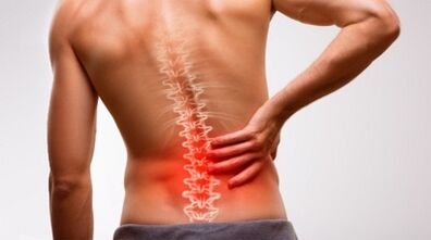 Signs and symptoms of osteochondrose lumbar spine